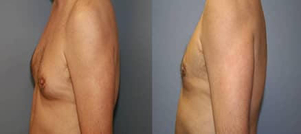 Slider image (7) Victor Regenerative Medicine Centers